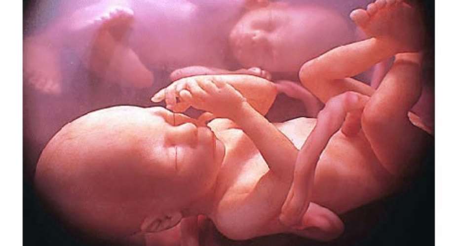 Dangerous abortions 'on the rise', says WHO