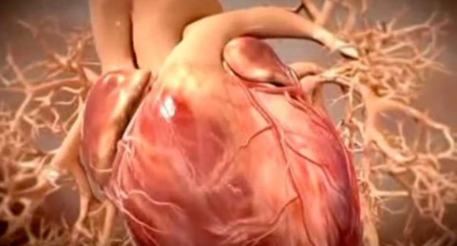 Scar tissue forms after a heart attack