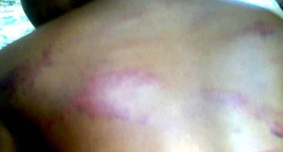 The 17 year old girl was allegedly beaten for going out without permit to buy food outside