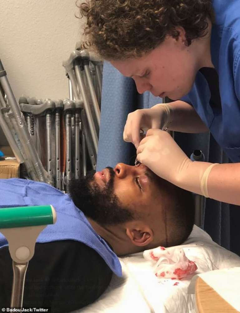 Boxer Suffers Horrific Head Injury During Bout (PHOTOS)