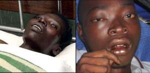 Right, an Ebola and Lassa fever victims