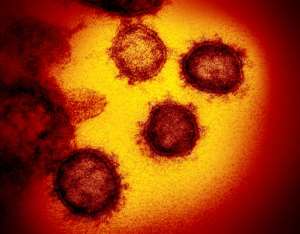 The Covid-19 virus can have long-lasting effects on those who contract it and research into the problem is just beginning. By Handout (National Institutes of Health/AFP)