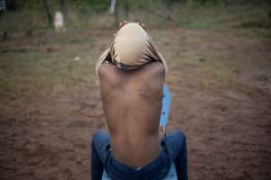 The rubber bullet in his son's back has made the farmer more vocal about Eswatini's convoluted political system. By Michele Spatari (AFP)