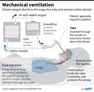 Schematic showing the components of a mechanical ventilator machine, highlighting the placement of a breathing tube in the trachea of a patient.. By John SAEKI (AFP)
