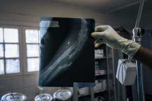 A nurse at Beni General Hospital shows an X-ray of a patient shot during an attack on a mining site. By ALEXIS HUGUET (AFP/File)