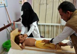 A Yemeni child suffering from severe malnutrition is measured at a treatment centre in a hospital in Yemen's northwestern Hajjah province. By ESSA AHMED (AFP/File)