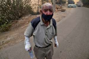 An injured man looks on during a wildfire in Tizi Ouzou. By Ryad KRAMDI (AFP)