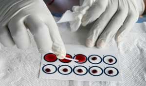 Blood tests show whether a person has been infected by the sleeping sickness parasite. By ISSOUF SANOGO (AFP)