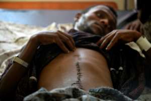 Kidane Tolosa, 23, was assaulted by a gang of fellow Oromos, maybe because he did not take part in the violence. By - (AFP)