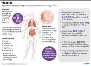 Factfile on measles.. By (AFP)