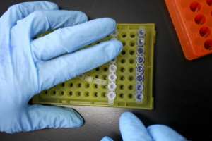 New research on HIV patients who can control the virus naturally may offer clues in the search for a cure. By STR (AFP/File)