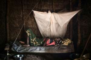 Parts of central Africa have fewer than one doctor for every 10,000 people. Pictured: a patient awaiting surgery last September at a camp for displaced people at Zapai, in the Democratic Republic of Congo. By FLORENT VERGNES (AFP)