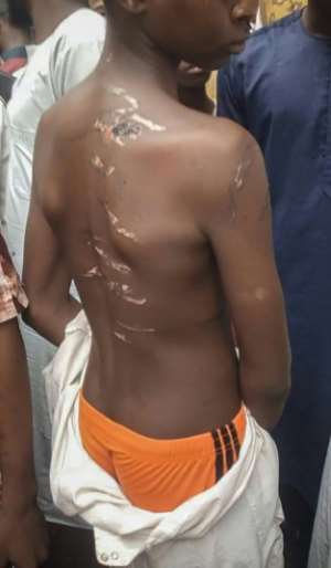 Some of the inmates at the Kaduna facility bore scars from alleged beatings. By - (AFP)