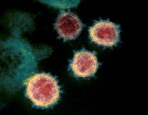 South Africa has been particularly hard-hit by the coronavirus pandemic, with around half the total number of cases detected on the continent. By Handout (National Institutes of Health/AFP/File)