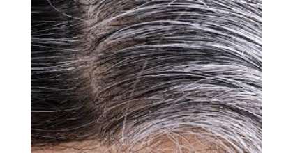 Scientists Discover 'Why Stress Turns Hair White'