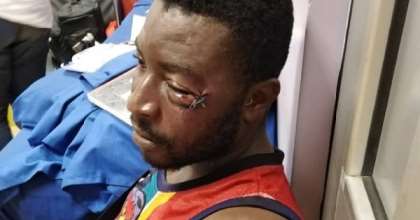 Complaints Against Patrick Allotey Who Assaulted A Football Fan In Stadium