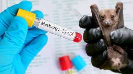 Ghana declares end of Marburg virus disease outbreak
